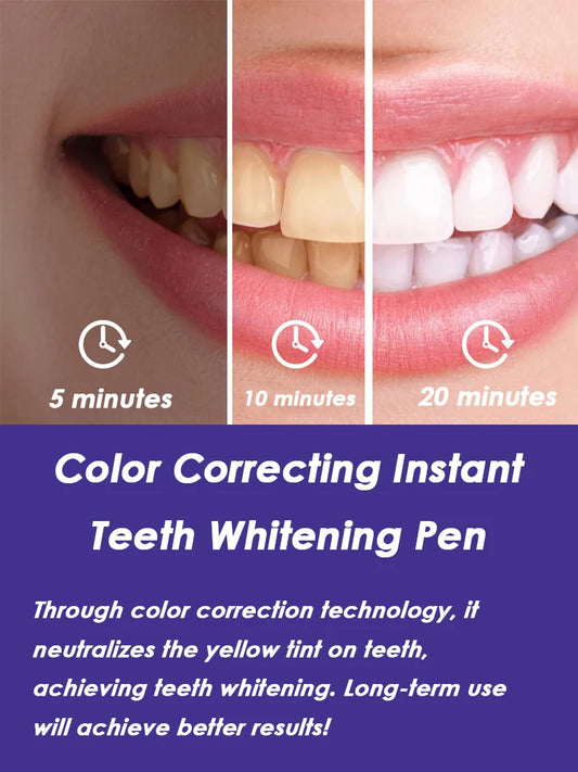 GlorySmile Instant Teeth Whitening Pen